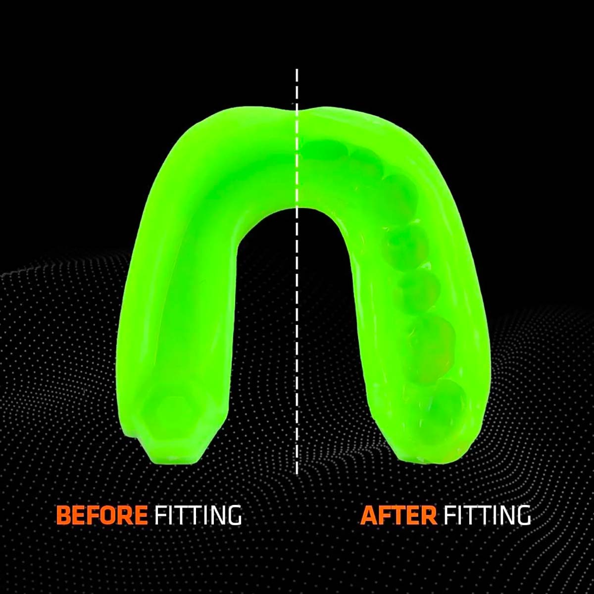 Protège-dents Gel Max Shock Doctor Adulte (11+) Vert fluo Exemple avant-après